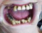 Dental__9981.JPG